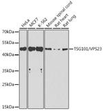 TSG101 Antibody in Western Blot (WB)