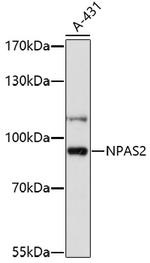 NPAS2 Antibody in Western Blot (WB)