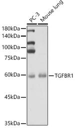 TGFBR1 Antibody in Western Blot (WB)