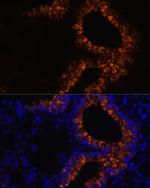 Uteroglobin Antibody in Immunocytochemistry (ICC/IF)