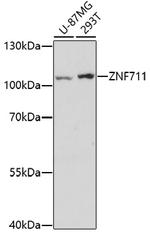 ZNF711 Antibody in Western Blot (WB)