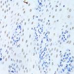 hnRNP K Antibody in Immunohistochemistry (Paraffin) (IHC (P))