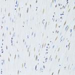 hnRNP K Antibody in Immunohistochemistry (Paraffin) (IHC (P))