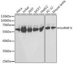 hnRNP K Antibody in Western Blot (WB)