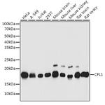 Cofilin Antibody in Western Blot (WB)