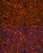 Beta III Tubulin Antibody in Immunohistochemistry (Paraffin) (IHC (P))