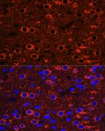 Beta III Tubulin Antibody in Immunohistochemistry (Paraffin) (IHC (P))