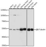 Beta III Tubulin Antibody in Western Blot (WB)