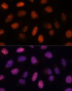 RPP38 Antibody in Immunocytochemistry (ICC/IF)