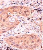 RPP38 Antibody in Immunohistochemistry (Paraffin) (IHC (P))