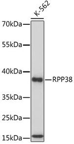 RPP38 Antibody in Western Blot (WB)