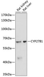 CYP27B1 Antibody in Western Blot (WB)