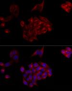 C1 inhibitor Antibody in Immunocytochemistry (ICC/IF)