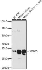 IGFBP5 Antibody in Western Blot (WB)