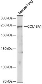 Endostatin Antibody in Western Blot (WB)