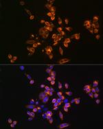 Annexin V Antibody in Immunocytochemistry (ICC/IF)