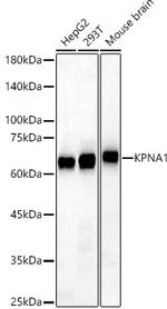 KPNA1 Antibody in Western Blot (WB)