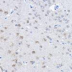 E6AP Antibody in Immunohistochemistry (Paraffin) (IHC (P))