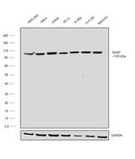 E6AP Antibody in Western Blot (WB)