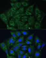 IGF2BP2 Antibody in Immunocytochemistry (ICC/IF)