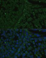 IGF2BP2 Antibody in Immunocytochemistry (ICC/IF)