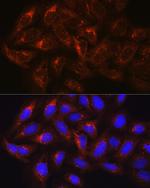 HGS Antibody in Immunocytochemistry (ICC/IF)