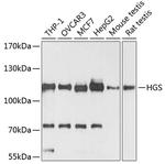 HGS Antibody in Western Blot (WB)