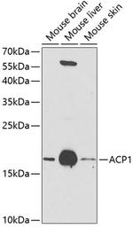 Acid Phosphatase 1 Antibody in Western Blot (WB)