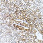 ALDH1A1 Antibody in Immunohistochemistry (Paraffin) (IHC (P))