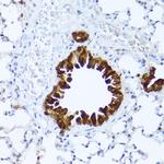 ALDH1A1 Antibody in Immunohistochemistry (Paraffin) (IHC (P))