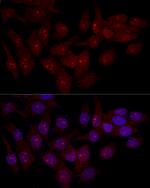 eIF6 Antibody in Immunocytochemistry (ICC/IF)