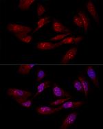 eIF6 Antibody in Immunocytochemistry (ICC/IF)