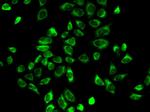 HSD3B2 Antibody in Immunocytochemistry (ICC/IF)