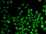 hnRNP D Antibody in Immunocytochemistry (ICC/IF)