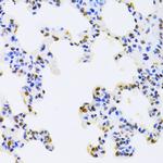 hnRNP D Antibody in Immunohistochemistry (Paraffin) (IHC (P))