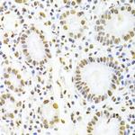 hnRNP D Antibody in Immunohistochemistry (Paraffin) (IHC (P))