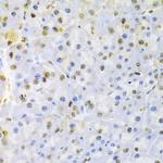 hnRNP D Antibody in Immunohistochemistry (Paraffin) (IHC (P))