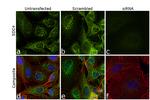 Syndecan 4 Antibody in Immunocytochemistry (ICC/IF)