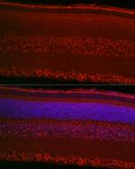 RPGR Antibody in Immunocytochemistry (ICC/IF)