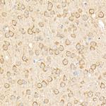 RPGR Antibody in Immunohistochemistry (Paraffin) (IHC (P))