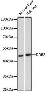 DDB2 Antibody in Western Blot (WB)