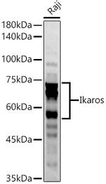 IKAROS Antibody in Western Blot (WB)