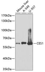 CES1 Antibody in Western Blot (WB)