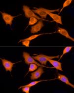 Iduronate 2 Sulfatase Antibody in Immunocytochemistry (ICC/IF)