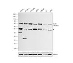 GLB1 Antibody in Western Blot (WB)