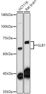 GLB1 Antibody in Western Blot (WB)