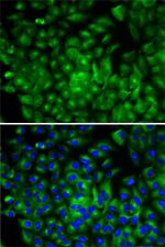 ATG16L1 Antibody in Immunocytochemistry (ICC/IF)