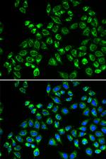 C1QBP Antibody in Immunocytochemistry (ICC/IF)