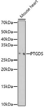 PTGDS Antibody in Western Blot (WB)