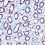 PDHA1 Antibody in Immunohistochemistry (Paraffin) (IHC (P))